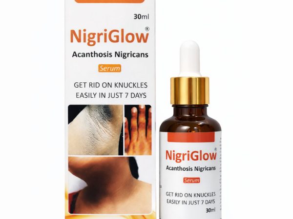 Nigriglow Acanthosis Nigricans Serum